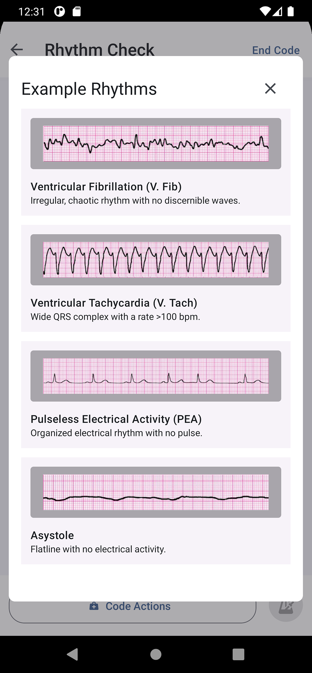 Example Rhythms panel showing V-fib, V-tach, PEA and asystole strips.